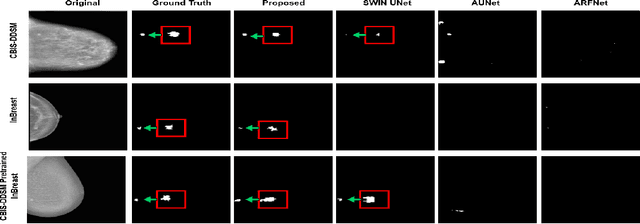 Figure 4 for SWIN-SFTNet : Spatial Feature Expansion and Aggregation using Swin Transformer For Whole Breast micro-mass segmentation