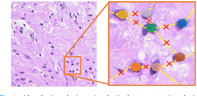 Figure 4 for Structure Embedded Nucleus Classification for Histopathology Images