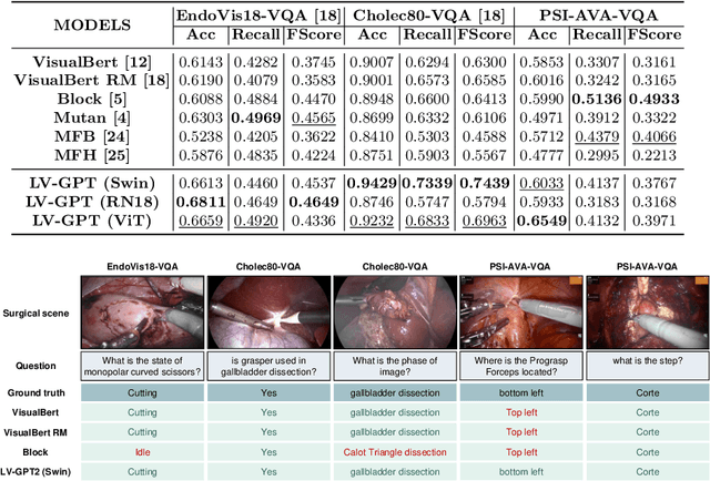 Figure 2 for SurgicalGPT: End-to-End Language-Vision GPT for Visual Question Answering in Surgery