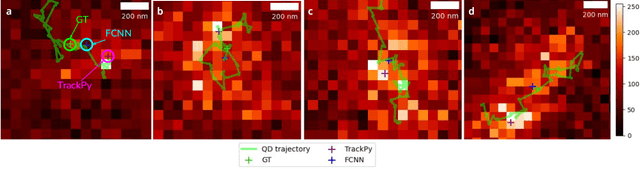 Figure 4 for Deep Learning-Assisted Localisation of Nanoparticles in synthetically generated two-photon microscopy images