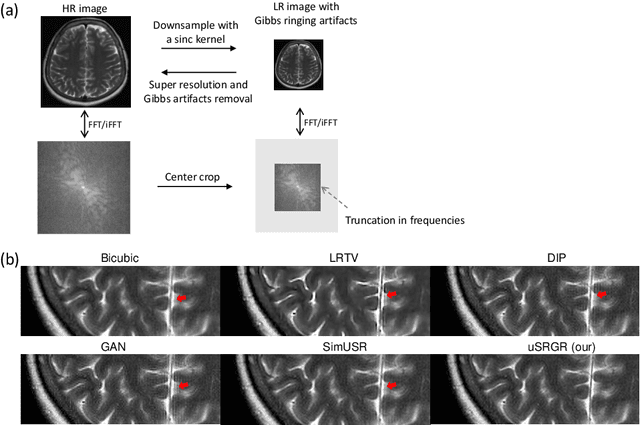 Figure 1 for An Unsupervised Framework for Joint MRI Super Resolution and Gibbs Artifact Removal