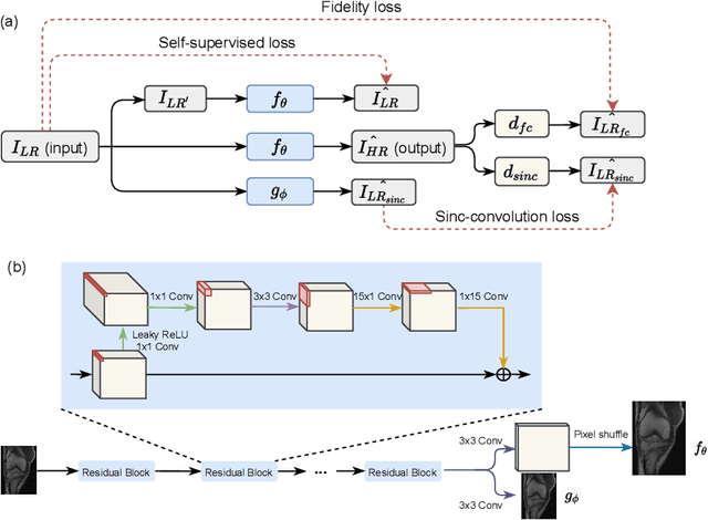 Figure 3 for An Unsupervised Framework for Joint MRI Super Resolution and Gibbs Artifact Removal