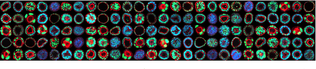 Figure 1 for Correlation Clustering of Organoid Images