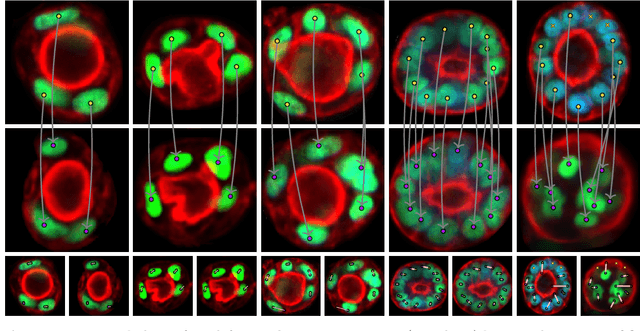 Figure 3 for Correlation Clustering of Organoid Images