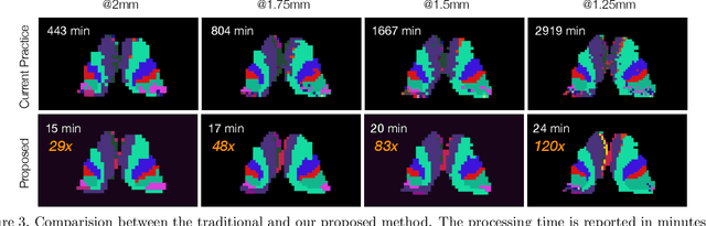 Figure 3 for FastCod: Fast Brain Connectivity in Diffusion Imaging