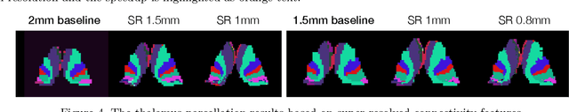 Figure 4 for FastCod: Fast Brain Connectivity in Diffusion Imaging