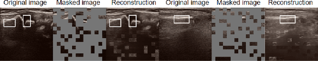 Figure 2 for Self-supervised TransUNet for Ultrasound regional segmentation of the distal radius in children