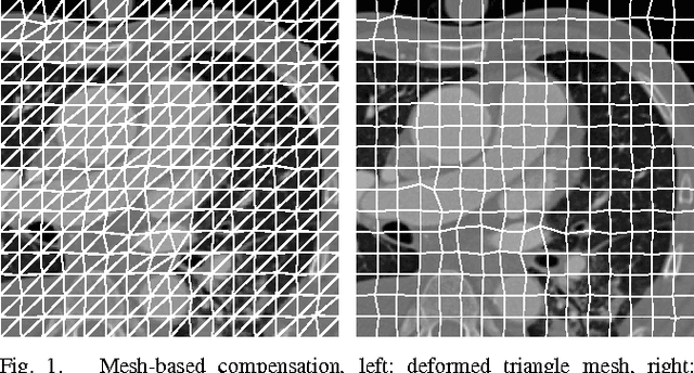 Figure 1 for Analysis of mesh-based motion compensation in wavelet lifting of dynamical 3-D+t CT data