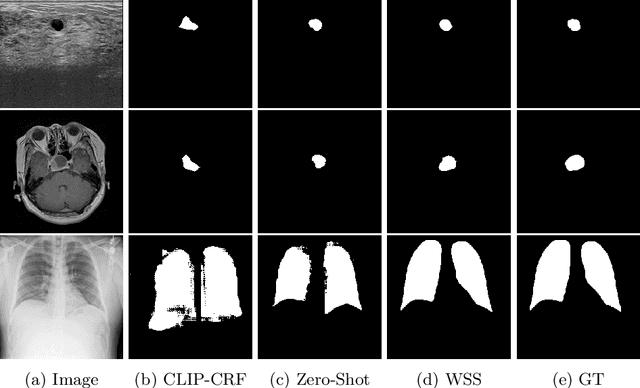 Figure 4 for MedCLIP-SAM: Bridging Text and Image Towards Universal Medical Image Segmentation