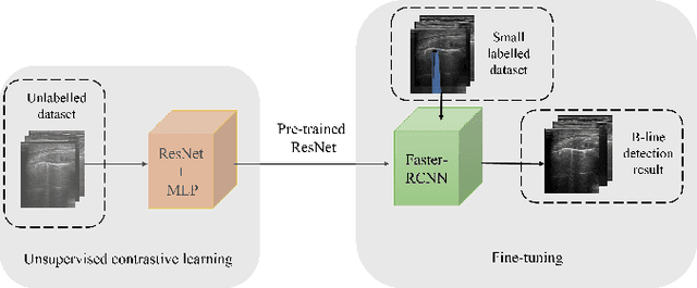Figure 1 for A Semi-supervised Learning Approach for B-line Detection in Lung Ultrasound Images