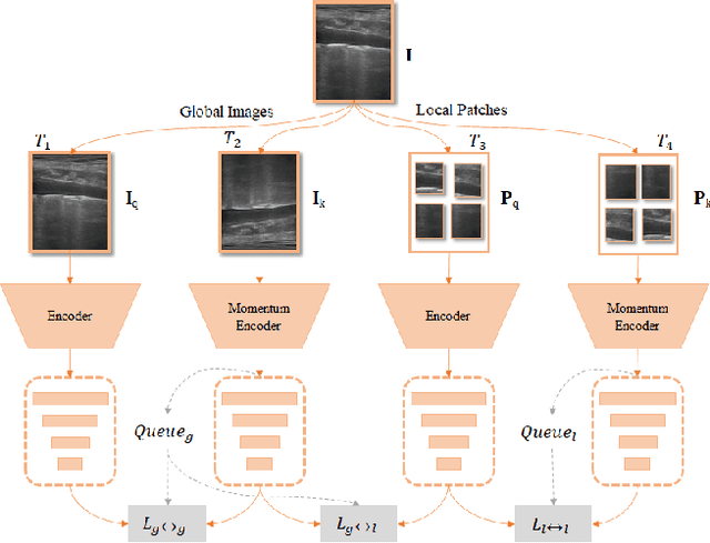 Figure 3 for A Semi-supervised Learning Approach for B-line Detection in Lung Ultrasound Images