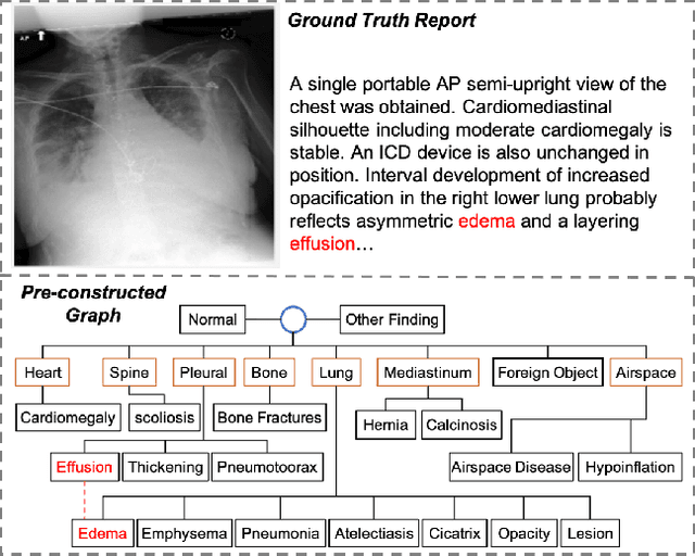 Figure 1 for Dynamic Graph Enhanced Contrastive Learning for Chest X-ray Report Generation