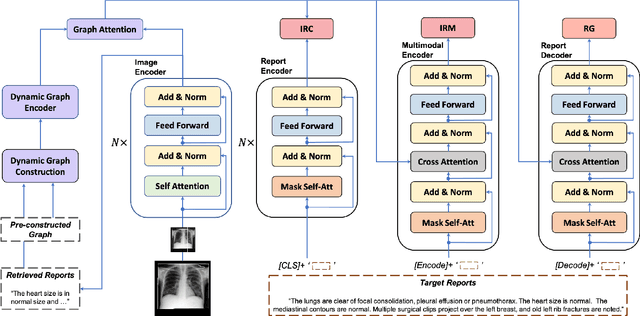 Figure 3 for Dynamic Graph Enhanced Contrastive Learning for Chest X-ray Report Generation