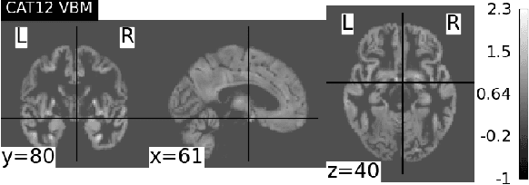Figure 2 for Robust Brain Age Estimation via Regression Models and MRI-derived Features
