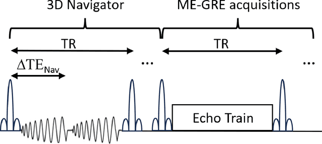 Figure 3 for Motion and temporal B0 shift corrections for quantitative susceptibility mapping (QSM) and R2* mapping using dual-echo spiral navigators and conjugate-phase reconstruction