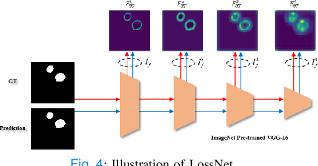 Figure 4 for M$^{2}$SNet: Multi-scale in Multi-scale Subtraction Network for Medical Image Segmentation