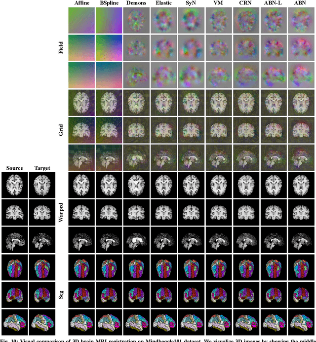 Figure 2 for ABN: Anti-Blur Neural Networks for Multi-Stage Deformable Image Registration