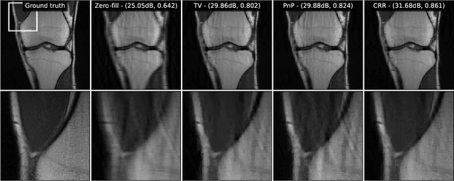 Figure 3 for A Neural-Network-Based Convex Regularizer for Image Reconstruction