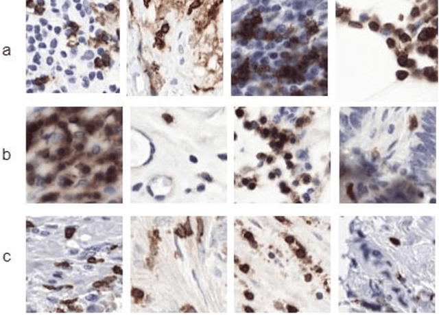 Figure 1 for CB-HVTNet: A channel-boosted hybrid vision transformer network for lymphocyte assessment in histopathological images