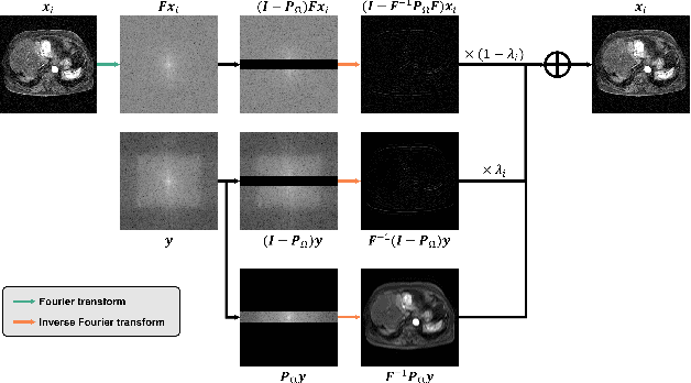 Figure 2 for Annealed Score-Based Diffusion Model for MR Motion Artifact Reduction