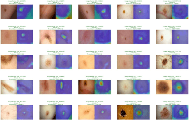 Figure 3 for LesionAid: Vision Transformers-based Skin Lesion Generation and Classification