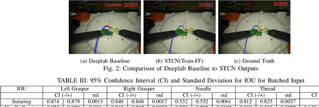 Figure 4 for Robotic Scene Segmentation with Memory Network for Runtime Surgical Context Inference