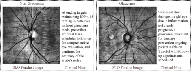 Figure 2 for FairCLIP: Harnessing Fairness in Vision-Language Learning