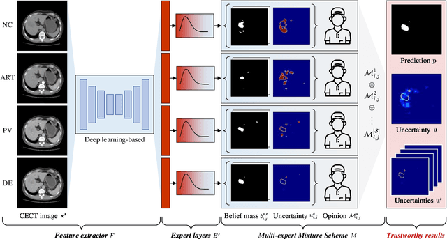 Figure 2 for Trustworthy Multi-phase Liver Tumor Segmentation via Evidence-based Uncertainty