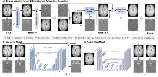 Figure 1 for Iterative Learning for Joint Image Denoising and Motion Artifact Correction of 3D Brain MRI