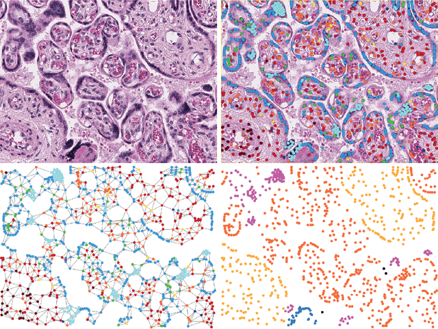 Figure 3 for A New Graph Node Classification Benchmark: Learning Structure from Histology Cell Graphs