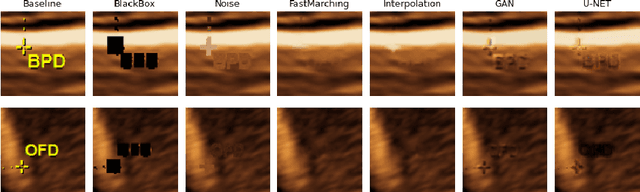 Figure 3 for Removing confounding information from fetal ultrasound images