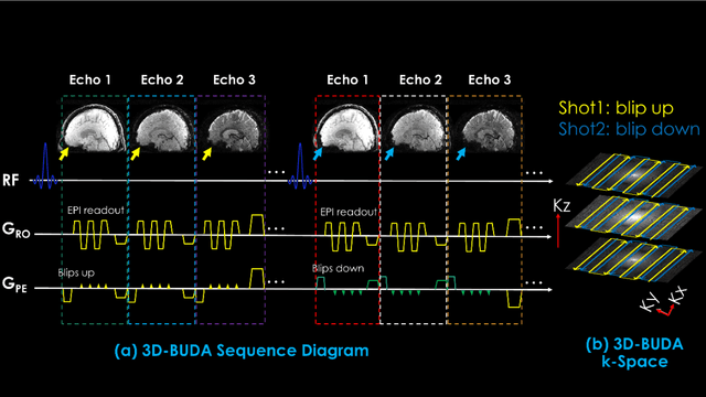 Figure 2 for 3D-EPI Blip-Up/Down Acquisition (BUDA) with CAIPI and Joint Hankel Structured Low-Rank Reconstruction for Rapid Distortion-Free High-Resolution T2* Mapping