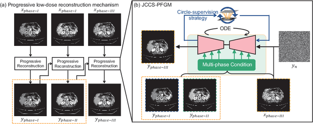 Figure 3 for JCCS-PFGM: A Novel Circle-Supervision based Poisson Flow Generative Model for Multiphase CECT Progressive Low-Dose Reconstruction with Joint Condition