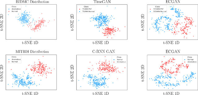 Figure 3 for ECGAN: Self-supervised generative adversarial network for electrocardiography