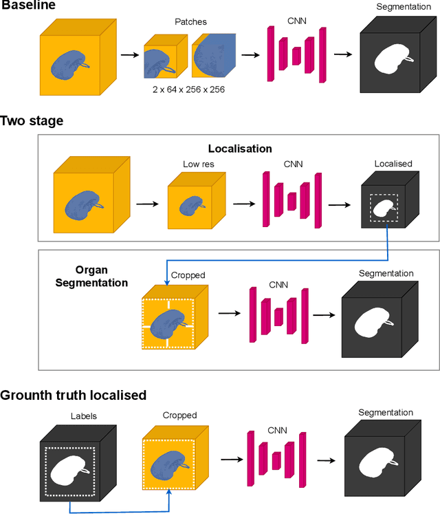 Figure 2 for Localise to segment: crop to improve organ at risk segmentation accuracy