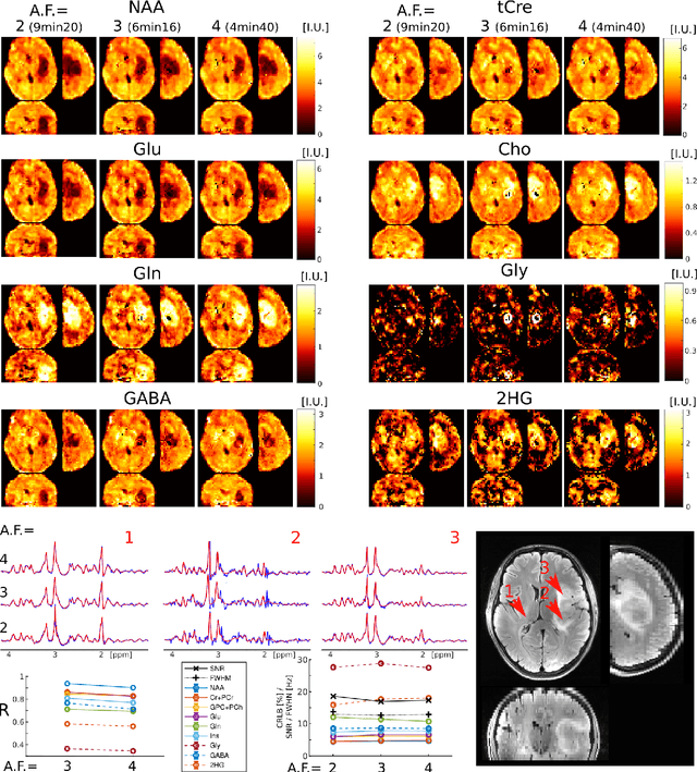 Figure 4 for ECCENTRIC: a fast and unrestrained approach for high-resolution in vivo metabolic imaging at ultra-high field MR