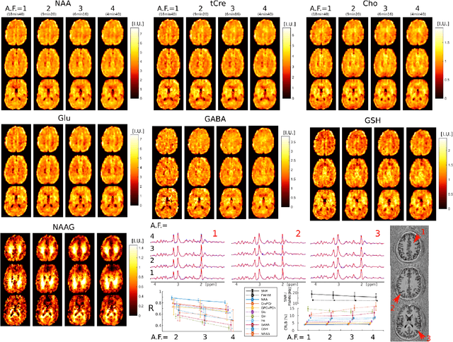 Figure 3 for ECCENTRIC: a fast and unrestrained approach for high-resolution in vivo metabolic imaging at ultra-high field MR
