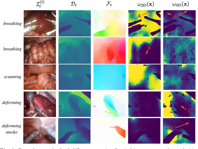 Figure 4 for Learning How To Robustly Estimate Camera Pose in Endoscopic Videos