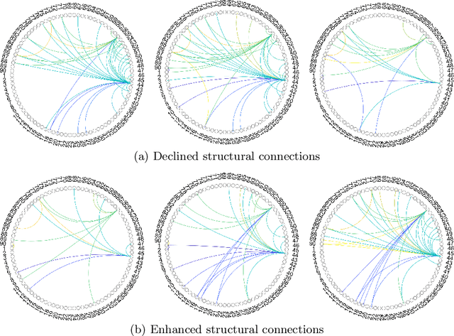 Figure 4 for Brain Diffuser: An End-to-End Brain Image to Brain Network Pipeline