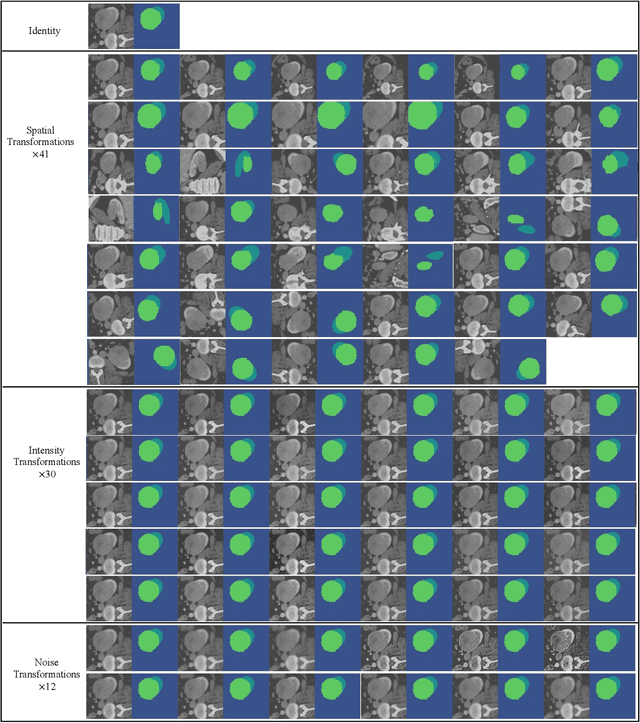 Figure 2 for Joint Optimization of Class-Specific Training- and Test-Time Data Augmentation in Segmentation