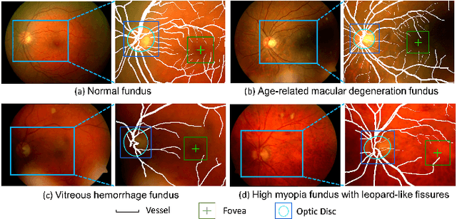 Figure 1 for JOINEDTrans: Prior Guided Multi-task Transformer for Joint Optic Disc/Cup Segmentation and Fovea Detection