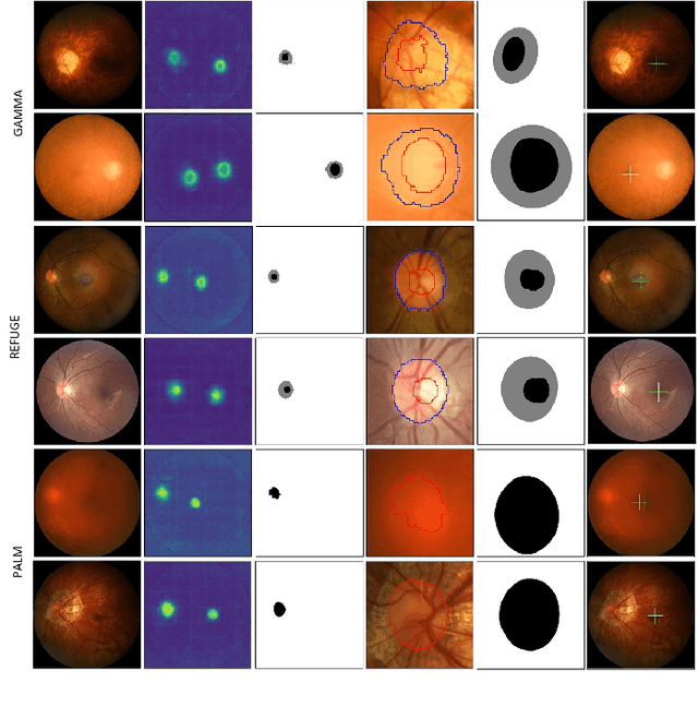 Figure 4 for JOINEDTrans: Prior Guided Multi-task Transformer for Joint Optic Disc/Cup Segmentation and Fovea Detection