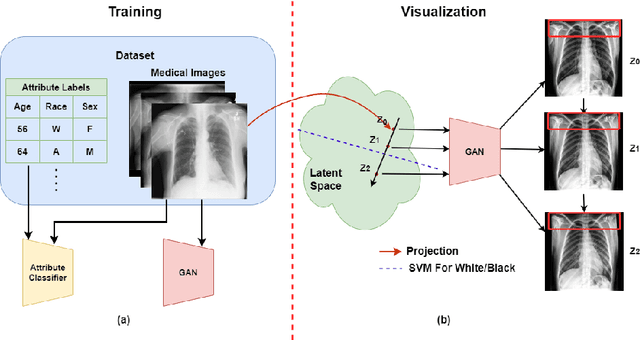 Figure 1 for Visualizing chest X-ray dataset biases using GANs