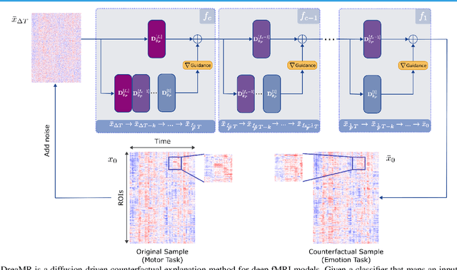 Figure 1 for DreaMR: Diffusion-driven Counterfactual Explanation for Functional MRI