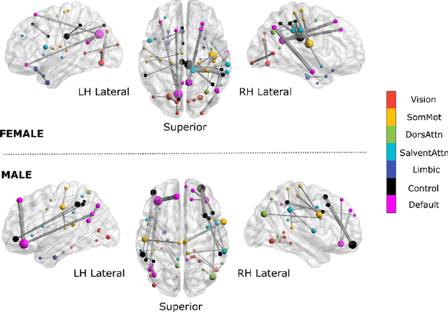 Figure 4 for DreaMR: Diffusion-driven Counterfactual Explanation for Functional MRI