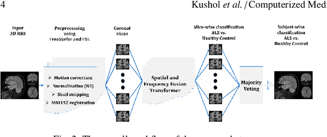 Figure 3 for SF2Former: Amyotrophic Lateral Sclerosis Identification From Multi-center MRI Data Using Spatial and Frequency Fusion Transformer