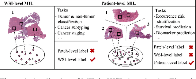 Figure 1 for HVTSurv: Hierarchical Vision Transformer for Patient-Level Survival Prediction from Whole Slide Image