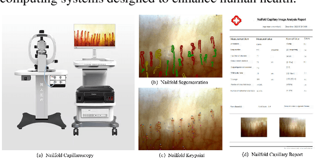 Figure 1 for A Comprehensive Dataset and Automated Pipeline for Nailfold Capillary Analysis