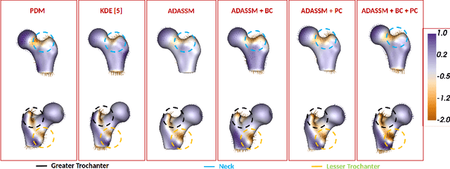 Figure 4 for ADASSM: Adversarial Data Augmentation in Statistical Shape Models From Images