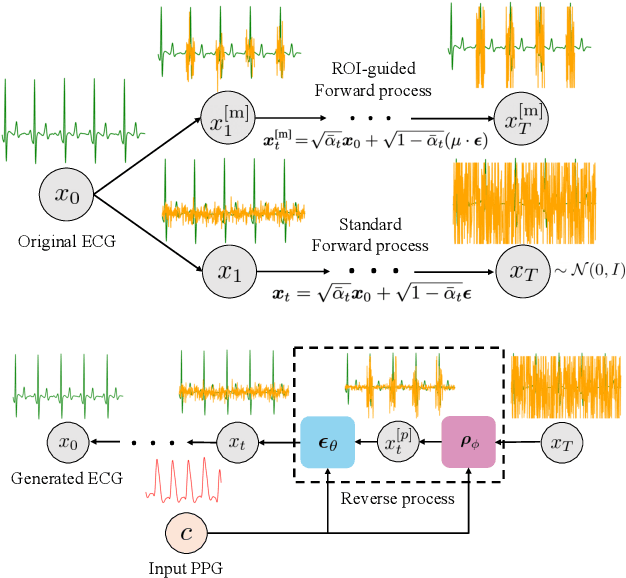 Figure 1 for Region-Disentangled Diffusion Model for High-Fidelity PPG-to-ECG Translation